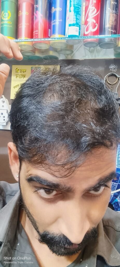 Jitendra Singh